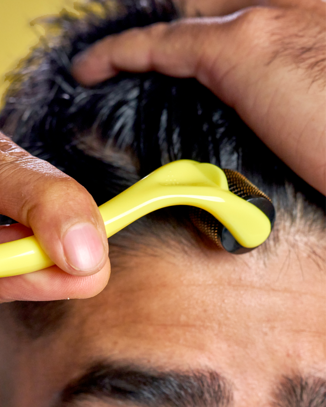 Derma Roller