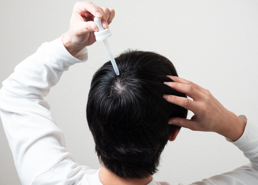 Mnoxidil: Everything You Need to Know about This Hair Loss Treatment