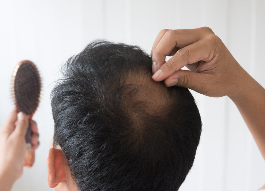 Fnasteride: Understanding How Long It Takes to Work for Hair Loss
