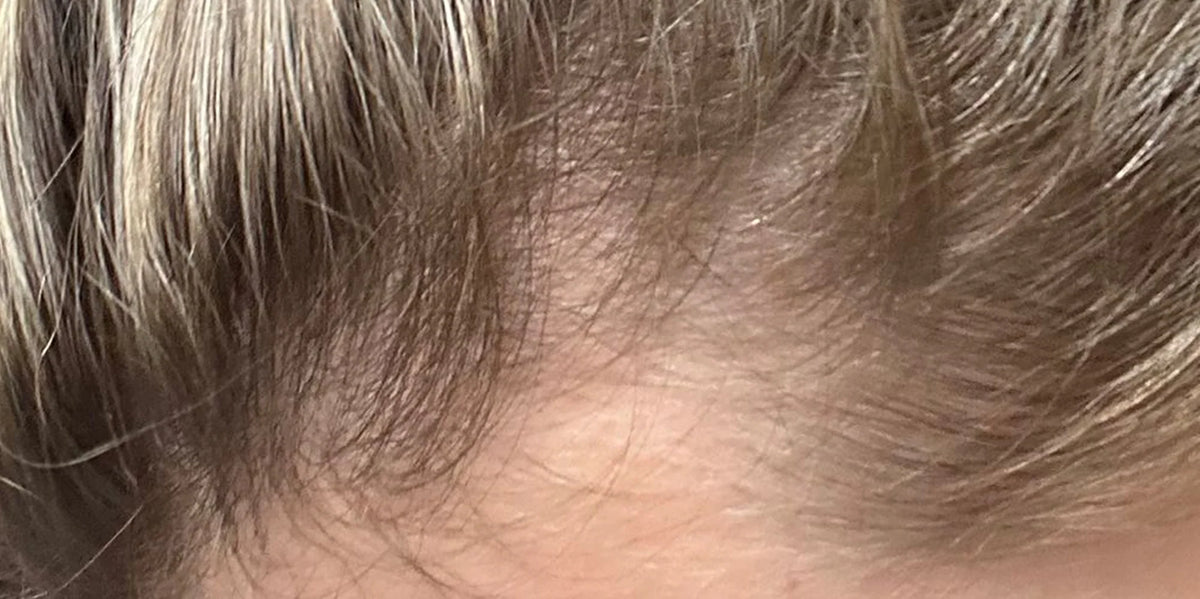 After